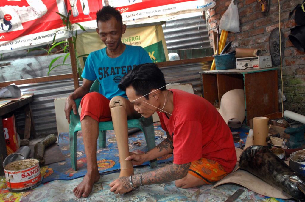 PROSTHETIC FOOT PRODUCTION